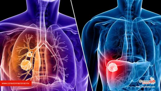 Suman 31 los casos de cáncer de pulmón y páncreas detectados durante este año
