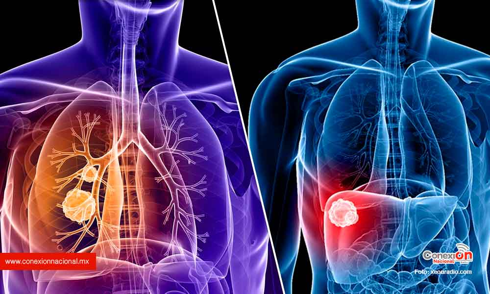 Suman 31 los casos de cáncer de pulmón y páncreas detectados durante este año
