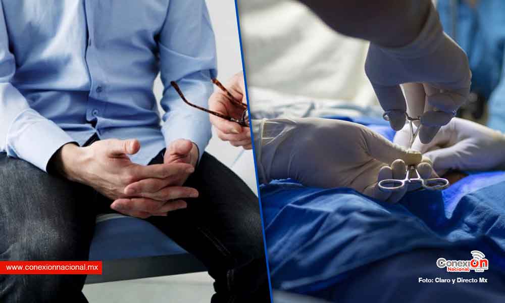 vasectomía no causa impotencia