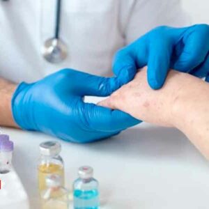 Chihuahua acumula 17 casos de viruela del mono