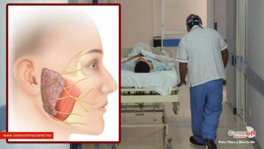 Diagnostican a 10 pacientes de Guanajuato con parálisis facial atípica