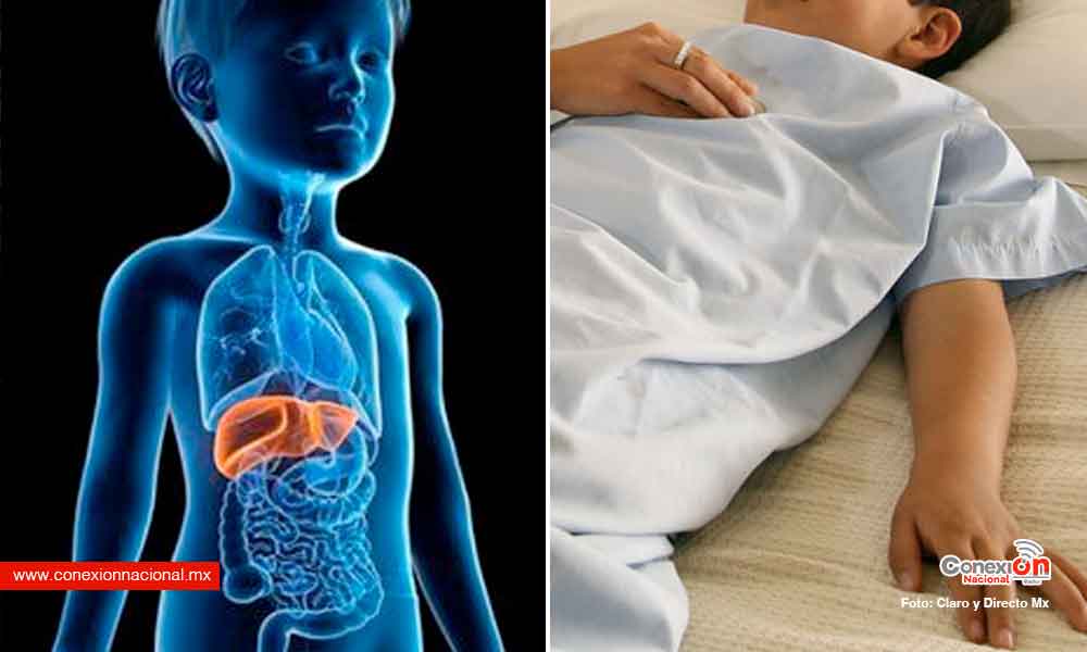 México suman 222 casos probables de hepatitis infantil aguda