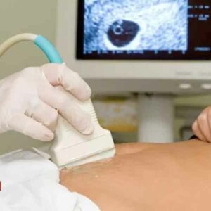 27 carpetas de investigación por aborto en la FGE Michoacán